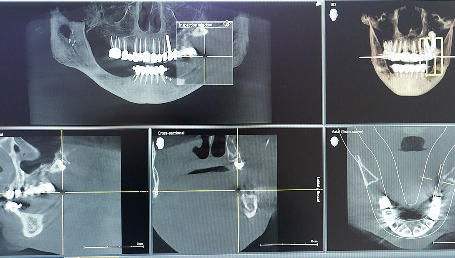 Dental Computed Tomography Scan